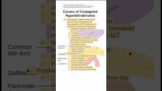 Causes of Conjugated Hyperbilirubinemia [upl. by Ossie]