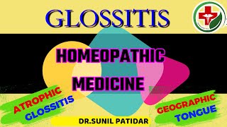 Glossitis tongue treatment  Glossitis homeopathic treatment  Glossitis homeopathic medicine [upl. by Novelia]