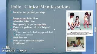 Microbiology 494 c PolioMyelitis Clinical Features Polio [upl. by Htessil722]