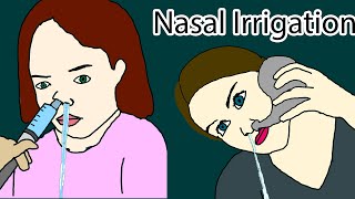 Nasal Irrigation  how to do nasal irrigation Nasal Rinse [upl. by Scherle814]