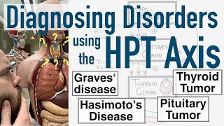 Diagnosing Disorders with HPT Axis  Pituitary and Thyroid Tumors Graves’ Hashimoto’s and Goiter [upl. by Jarred]