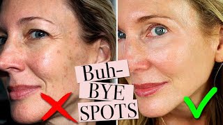 How To Get Rid of Age Spots [upl. by Annuhsal]