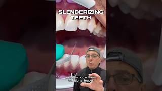 How Invisalign Can Fix Minimal Crowding of Teeth  View Mobile Dental shorts [upl. by Sitoeht]