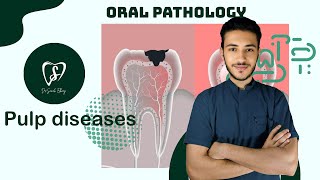 Pulp diseases  oral pathology [upl. by Kania]