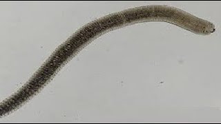 Para GIT  Hymenolepis Nana  Dwarf tape worm   الدودة القزمة [upl. by Natale125]