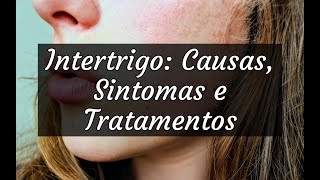 Intertrigo Causas Sintomas e Tratamentos [upl. by Manolo371]