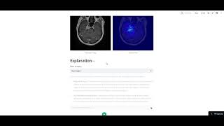 Brain MRI Tumor Detection  CNN Detailed Report Chatbot [upl. by Yurt8]