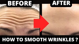 3 EFFECTIVE FACIAL EXERCISES FOR FOREHEAD WRINKLES  FOREHEAD LINES [upl. by Atikcir723]