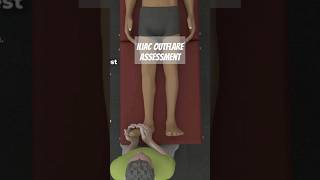 Iliac Outflare Assessment [upl. by Eissirc]