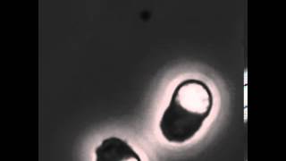 Crawling C elegans sperm [upl. by Alyat]