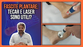 FASCITE PLANTARE la TECARTERAPIA e il LASER sono UTILI oppure SONO SOLDI BUTTATI [upl. by Robison]