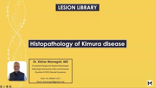 Histopathology of Kimura disease [upl. by Darrel527]