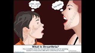 What is Dysarthria [upl. by Atirahc]