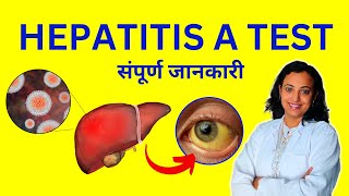 Hepatitis A Test Kya Hota Hai Kaise Hota Hai Procedure amp Report [upl. by Atrebor]