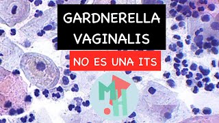 Debes saber esto de Gardnerella vaginalis NO ES UNA ITS [upl. by Ira847]