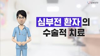 심부전 환자의 수술적 치료 [upl. by Ylrehc230]