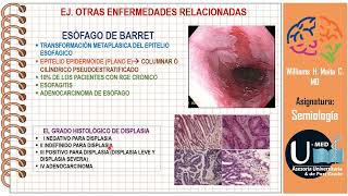 Semiología de Abdomen Clase 4 Síndromes abdominales [upl. by Navaj]