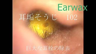 耳垢 よく取れる方法  귀청소가게 asmr  ear cleaning asmr कान का मैल निकालना P 18 [upl. by Hinckley]