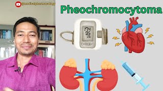 Pheochromocytoma  Cause Symptoms And Treatment  medicalpharmacology mbbs [upl. by Bushore258]