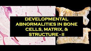 2  DEVELOPMENTAL ABNORMALITIES IN BONE CELLS MATRIX amp STRUCTURE  II [upl. by Attennaj]