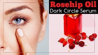 Rosehip Oil for Dark Circles Serum Recipe [upl. by Rett691]