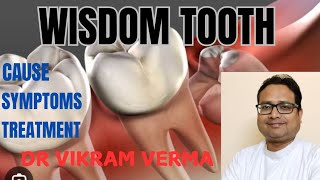 wisdom tooth pain amp treatmentakaldadh me dard aur uska ilaj [upl. by Guise]