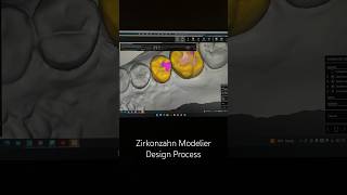 Zirkonzahn Modellier Design dental cadcam digitaldentistry [upl. by Sivra373]