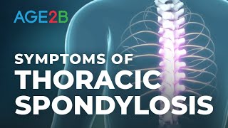 What Are the Symptoms of Thoracic Spondylosis Thoracic MidBack Pain or Disc Spondylolisthesis [upl. by Quitt226]