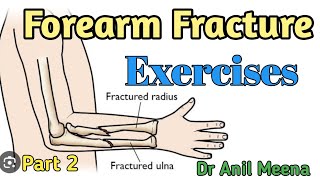 forearm fracture recovery exercises  forearm fracture physiotherapy  forearm exercises  in hindi [upl. by Kinnon]