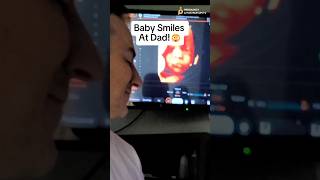 😭😭Baby Smiles At Dad During Ultrasound ADORABLE 🥹 [upl. by Eicyal]