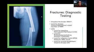 Adult MedSurg Introduction to Fracture NEW Lecture [upl. by Antoinette]