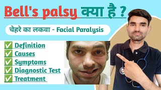 Bells palsy in Hindi  Causes Symptoms And Treatment of Bells palsy  Facial Paralysis in Hindi [upl. by Arabele]