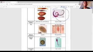 Trematodes Flukes Filipino [upl. by Adnorrehs]