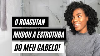 O ROACUTAN mudou a estrutura do meu cabelo [upl. by Urion569]