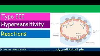 Lecture 6  Type III Hypersensitivity [upl. by Rand]