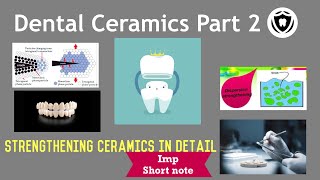 Dental Ceramics  Part 2 [upl. by Valonia655]