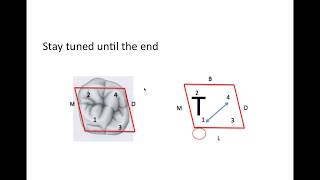 10 Maxillary 1st Molar  NBDE Part 1 Boards Study [upl. by Eynaffit]