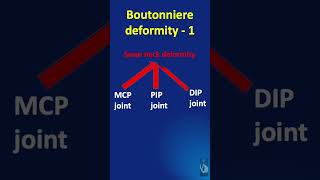 Shorts 83 Boutonniere deformity  what is it Explained in less than a minute [upl. by Arerrac]