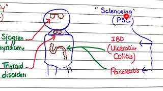 Primary Biliary Cholangitis and Primary Sclerosing Cholangitis  Pathology [upl. by Luke]