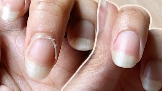 NAIL TRANSFORMATION  how I CUT CUTICLES at HOME  Basic Tools ONLY [upl. by Ennaimaj784]