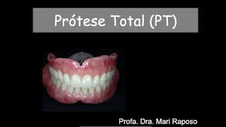 Plano de orientação Superior em prótese total  o passo a passo da técnica [upl. by Ailuig943]