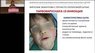 18022017  Дифференциальный диагноз экзантем у детей [upl. by Ellehsar]