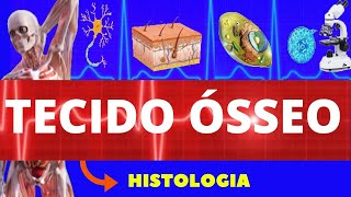 TECIDO ÓSSEO ENSINO SUPERIOR  HISTOLOGIA  CÉLULAS E ESTRUTURA DO TECIDO ÓSSEO [upl. by Varuag]