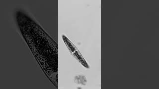 Closterium  Zieralgen  Desmidiales unter dem Mikroskop science algen 5 [upl. by Schreib813]