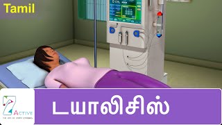 DIALYSIS  Tamil [upl. by Hansel]