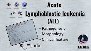 ALL Acute Lymphoblastic LeukemiaLymphoma  Disorders of White Cells  Lymphoid neoplasm Pathology [upl. by Ardnoel]