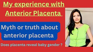 My experience with Anterior placentaAnterior Placenta complications and baby gender [upl. by Yelahs]