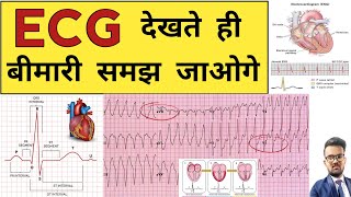 ECG Report  ECG Report Reading  ECG Report kaise Pade  Doctor  Hospital  Nursing  BHMS  BAMS [upl. by Ambrose]