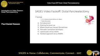 SAGES distal pancreatectomy video faceoff [upl. by Annais]