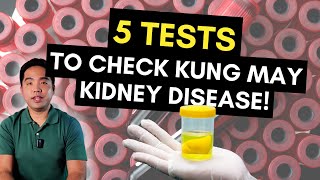 5 Tests Para Malaman Kung May Kidney Disease [upl. by Nitsoj587]